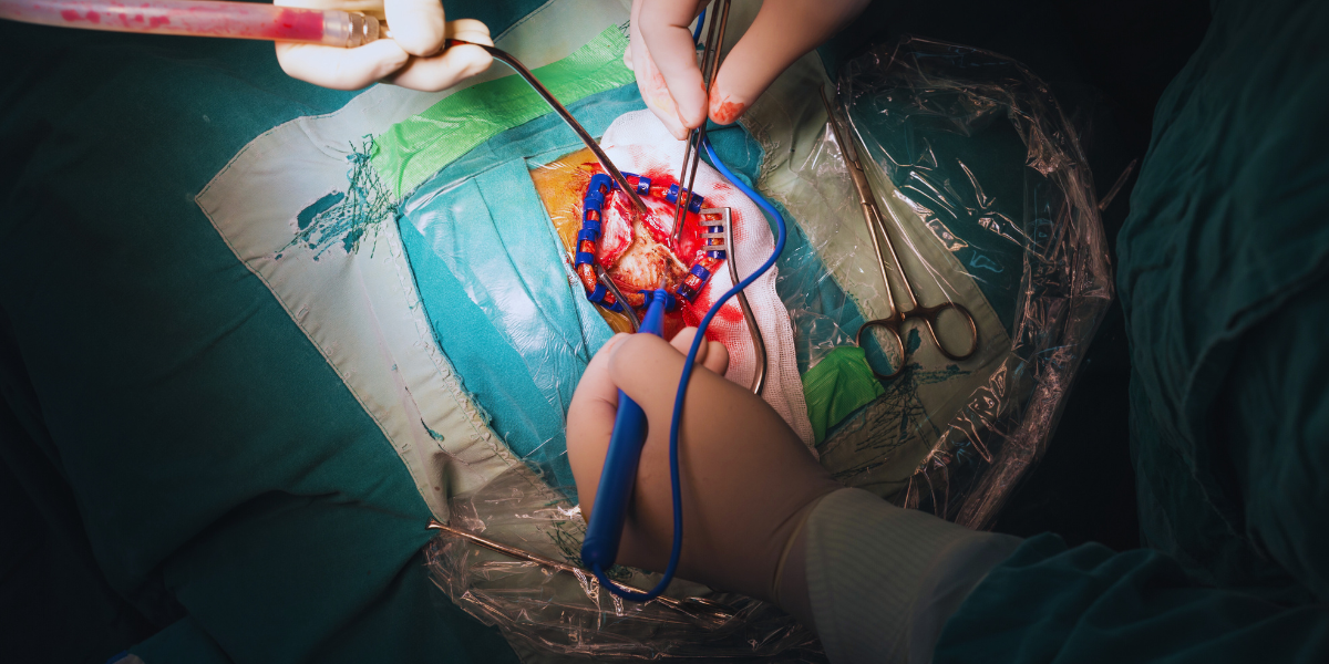 Tipos de hemorragia intracraniana