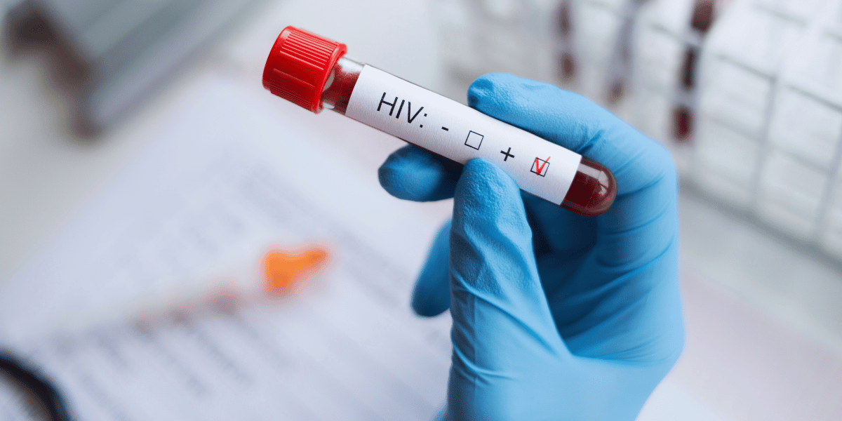 Como funciona o tratamento do HIV