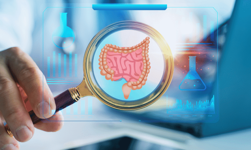 microbiota intestinal